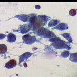 Ομάδα κυττάρων ενδοτραχήλου